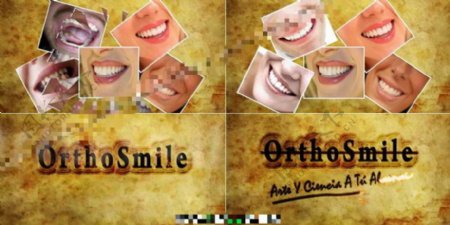 牙齿整形宣传广告AE模板