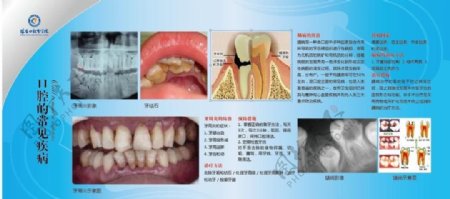 口腔的常见疾病图片