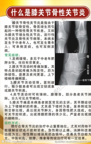 膝关节关节炎图片