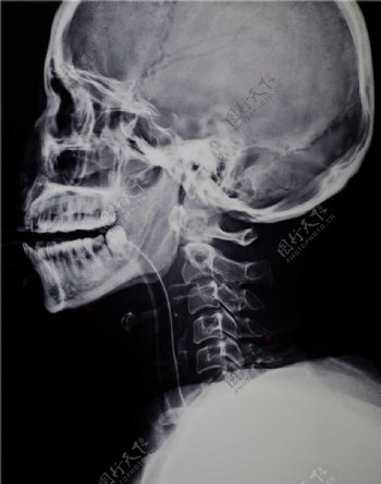 头部X光片图片