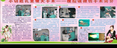腹腔镜手术简介图片