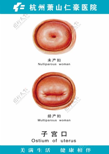 子宫口图片