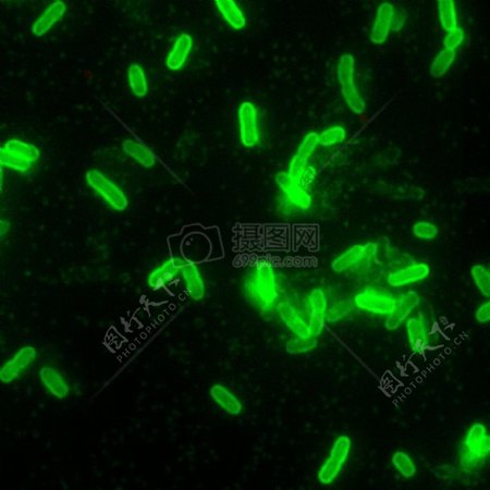 鼠疫耶尔森氏菌直接荧光抗体染色DFA放大200倍