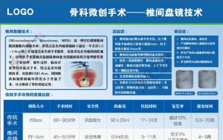 椎间盘镜技术